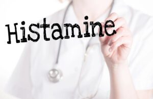 Histamine and Gout