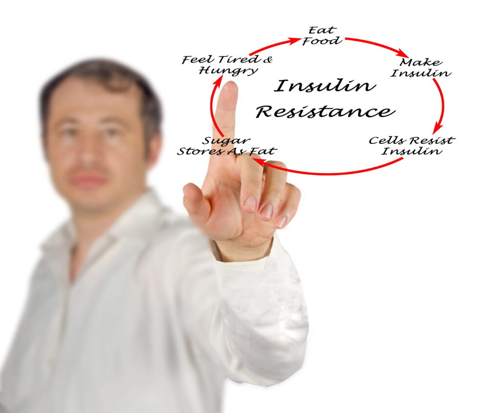 Link between gout and insulin resistance.
